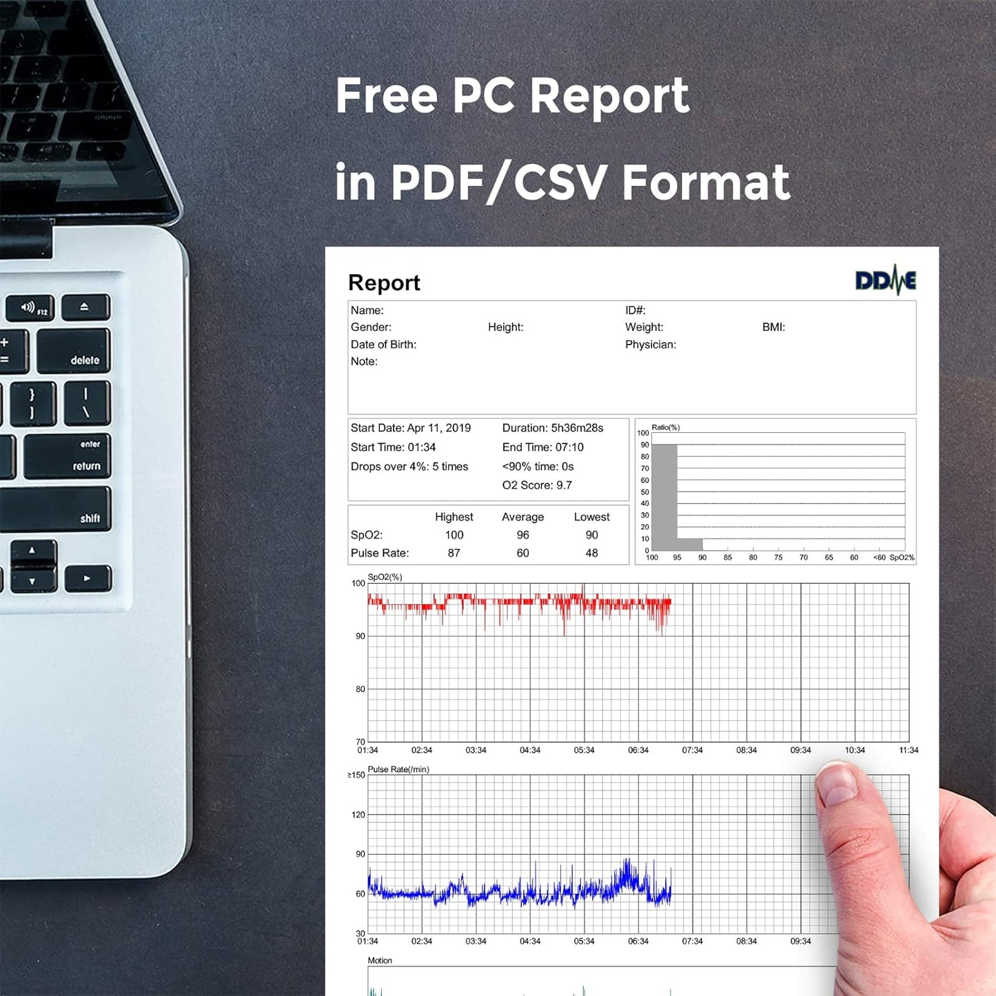 O2Ring Pulse Oximter